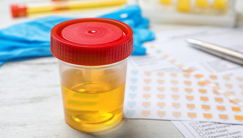 Особенности переработки мочи